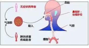 败血症会引起肺部感染吗