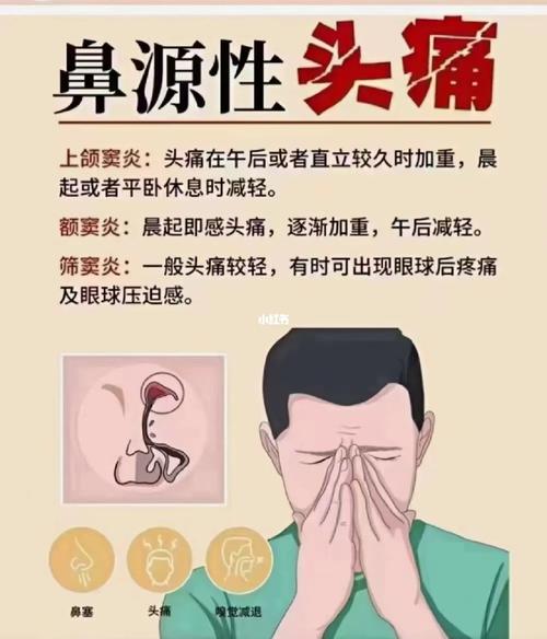 鼻痛、头痛、腮痛怎么了？