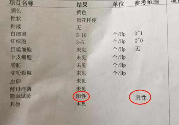 大便隐血跟胃癌有关系吗