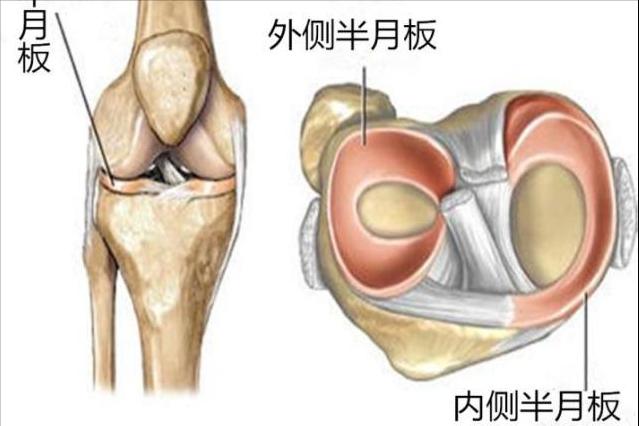 骨质增生半月板损伤症状