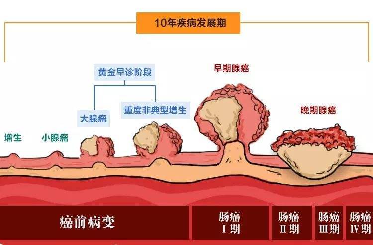 结肠癌的危害有哪些