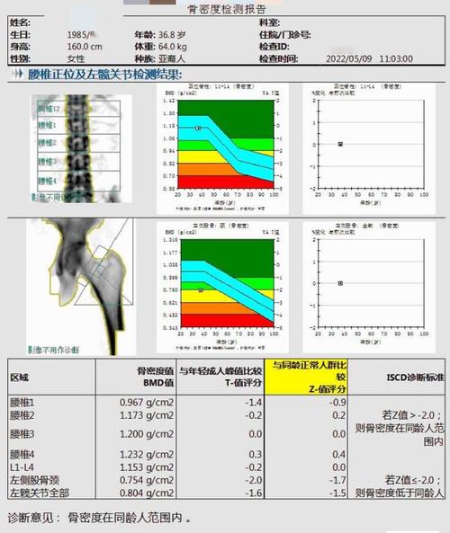 骨质疏松会引起关节痛z