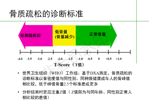 骨质疏松会引起关节痛z