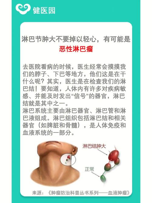 鼻型淋巴癌发烧什么原因