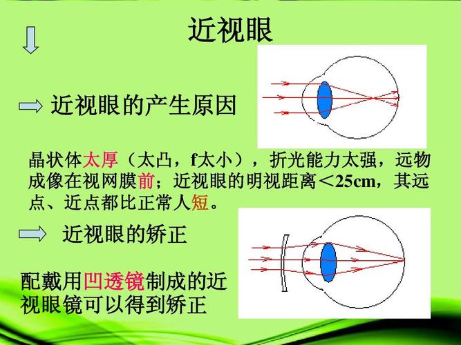 近视眼是怎么回事