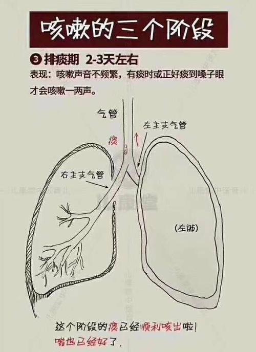 长达十年的咳嗽该怎么办