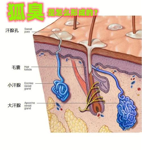 腋下狐臭还有疙瘩怎么办