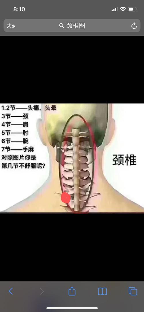 颈椎骨质增生头没有知觉是什么原因