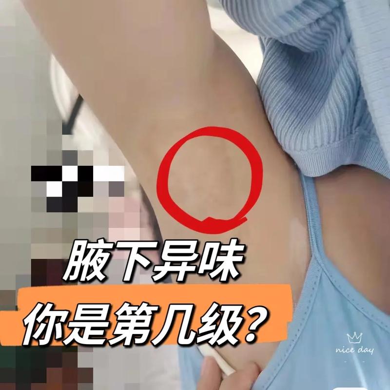 腋窝下有味道就是狐臭吗