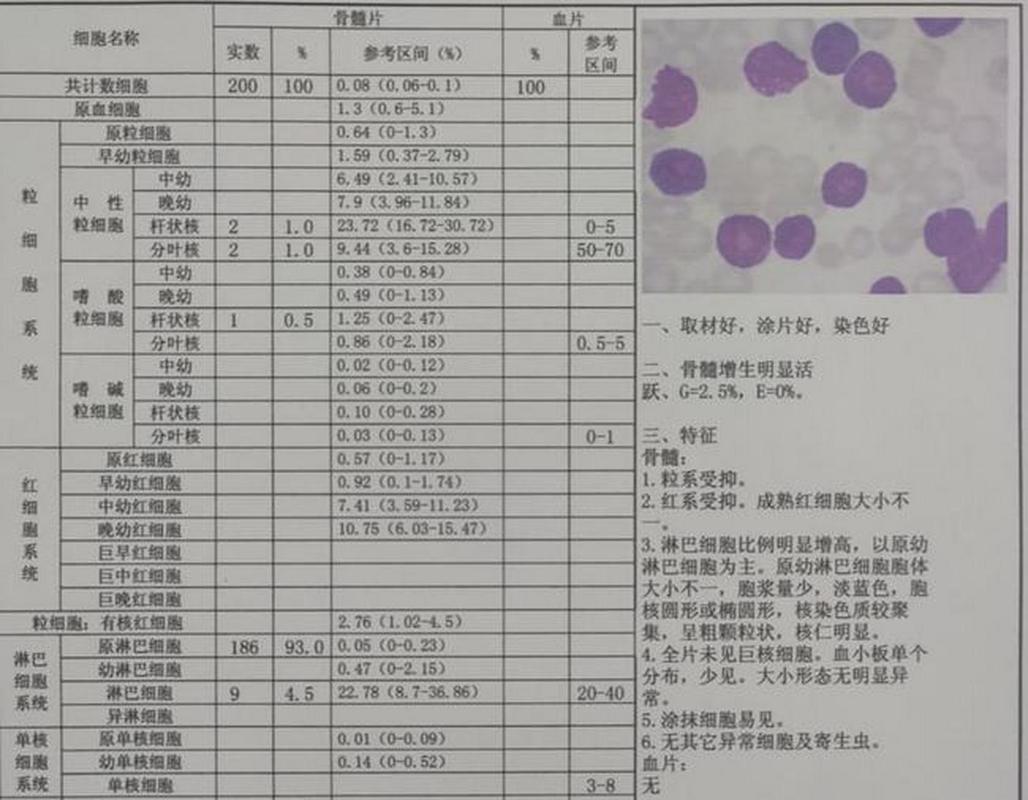 慢粒白血病可以生孩子吗