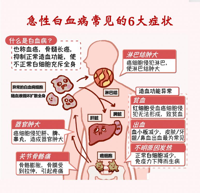 怎么判断急性白血病轻重