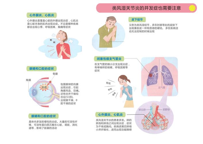 血瘀会变成类风湿吗