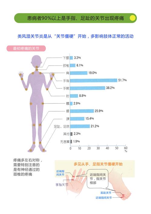 血瘀会变成类风湿吗