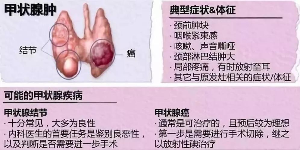 甲状腺癌到底是什么意思