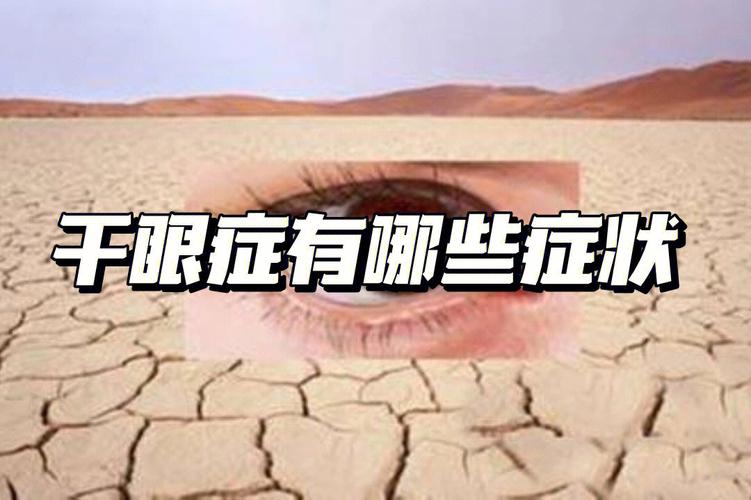 眼泪挺多的会是干眼症吗