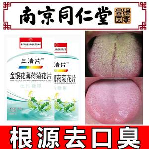 舌苔白厚腻口臭吃什么药