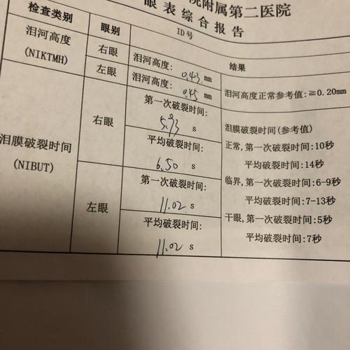 做干眼症检查一般多少钱