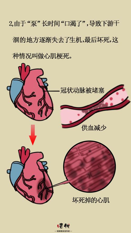 心肌缺血会不会引起贫血