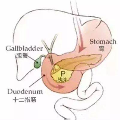 胆囊炎和痢疾的区别