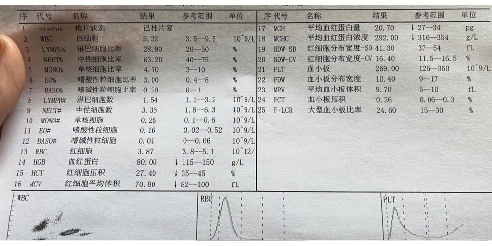 长期处于中度贫血怎么办