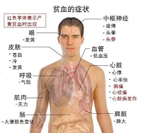 怎么判定是什么贫血症状