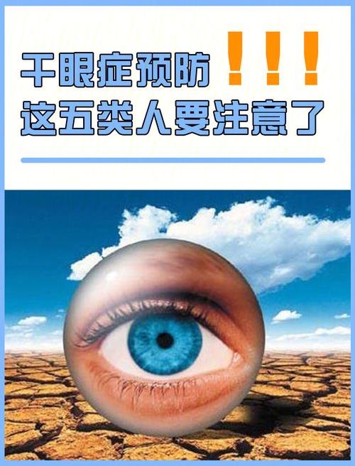 做干眼症检查需要空腹吗