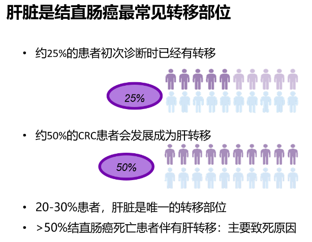 结肠癌转移肝可以治愈吗