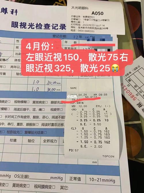 6岁散光100度严重吗