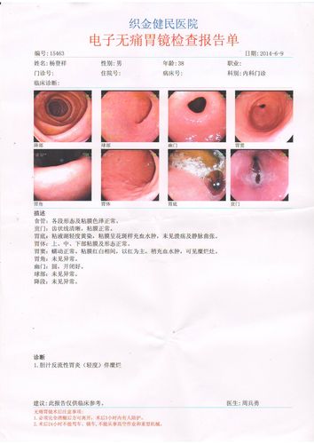 胃镜能立刻查出食道癌吗