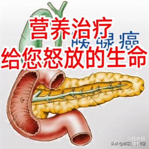 胰腺癌手术后感染率大吗