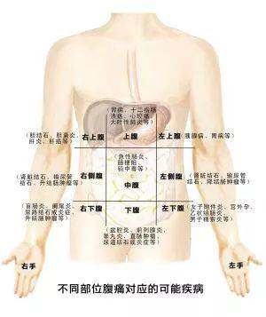 肚脐右腹部痛是胃溃疡吗