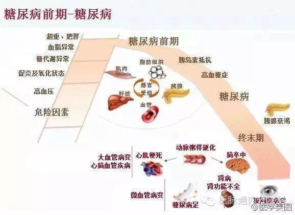 血脂异常和类风湿的关系