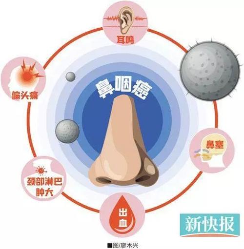 鼻咽癌放疗后头痛怎么办