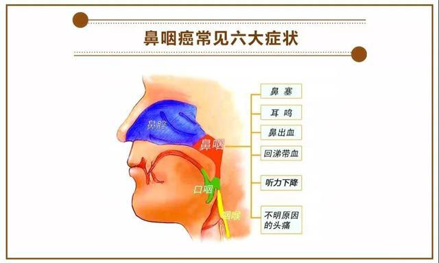 鼻咽癌放疗后头痛怎么办