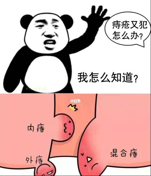 大便不成形是内痔疮吗