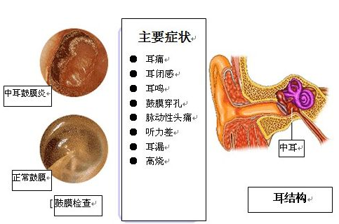 耳朵得了中耳炎怎么救命