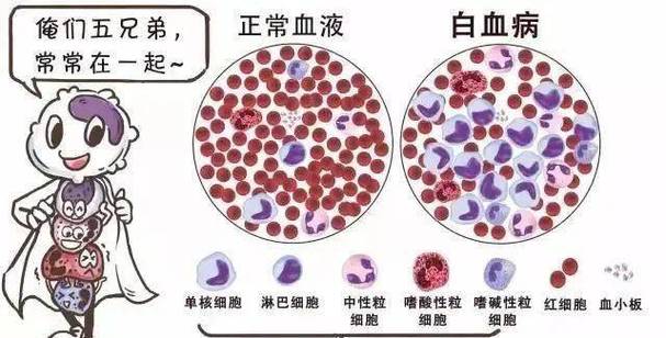 白血病与血小板低区别