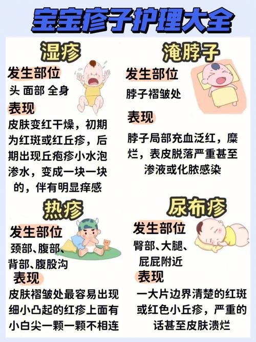 如何护理宝宝湿疹