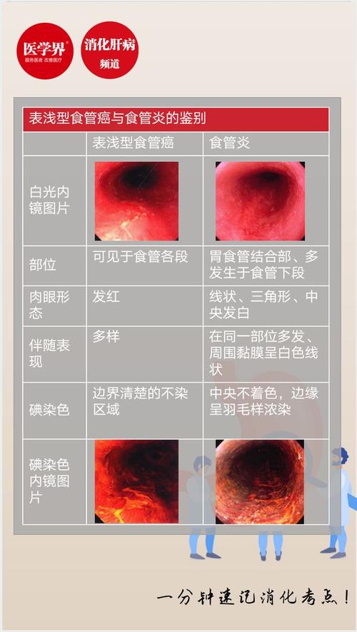 喉癌和食道癌的区别