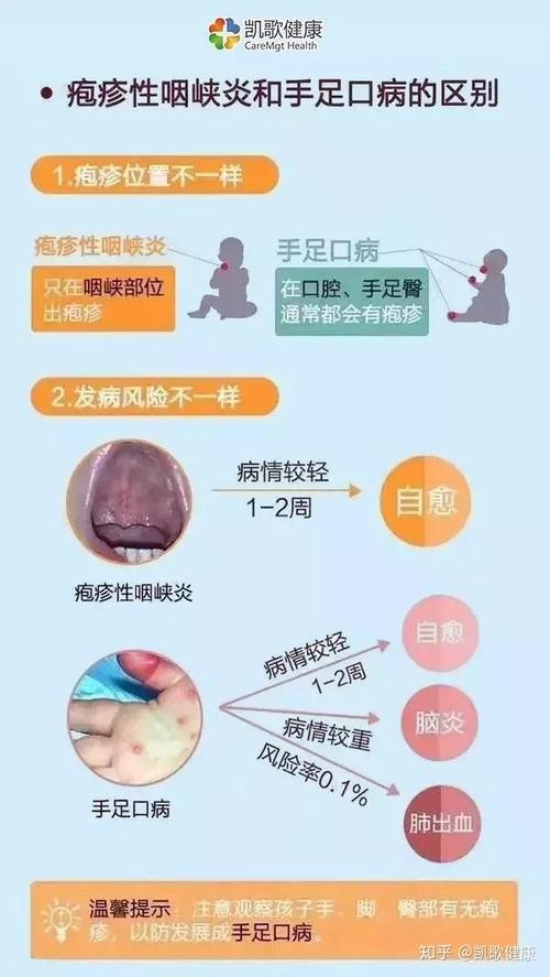 咽峡炎是手足口病吗