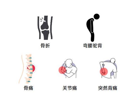 骨质疏松哪些关节痛