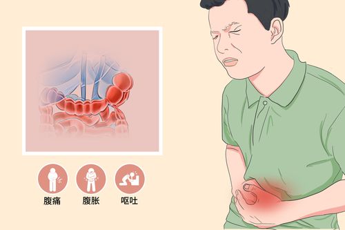 高龄老人肠梗阻怎么办