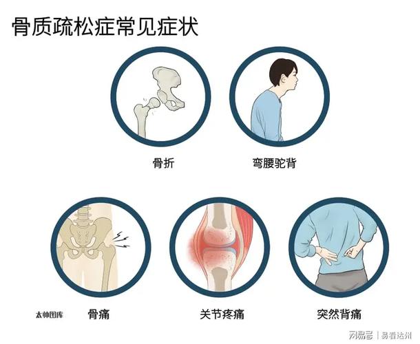 骨质疏松会引起关节痛