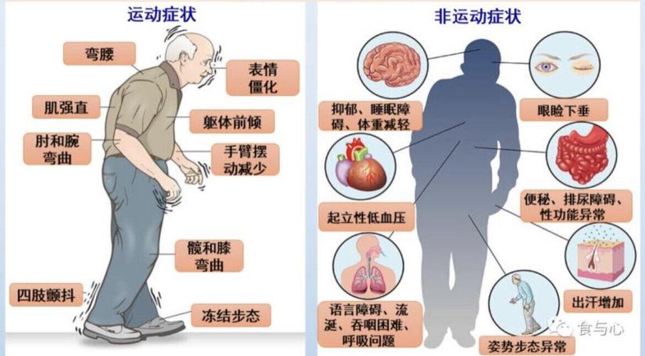 帕金森病并发症有哪些