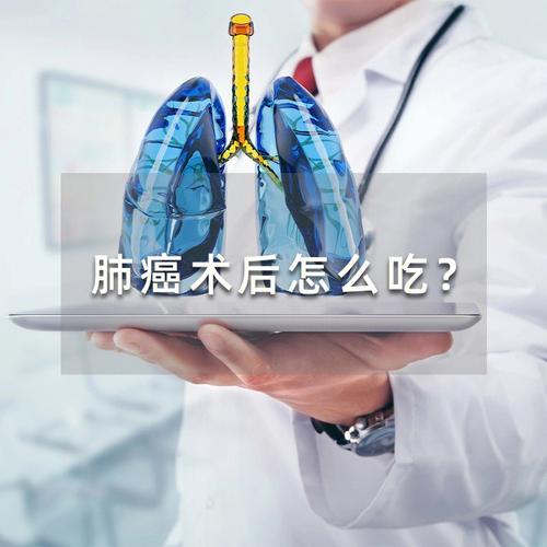 肺癌术后需要做化疗吗