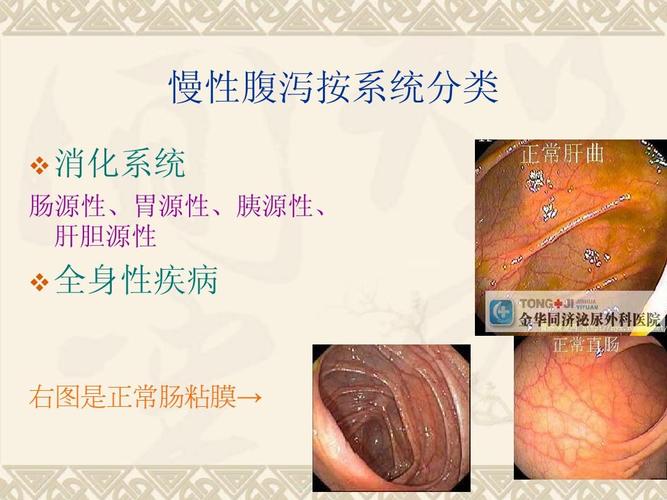 胰源性腹泻怎样治疗好