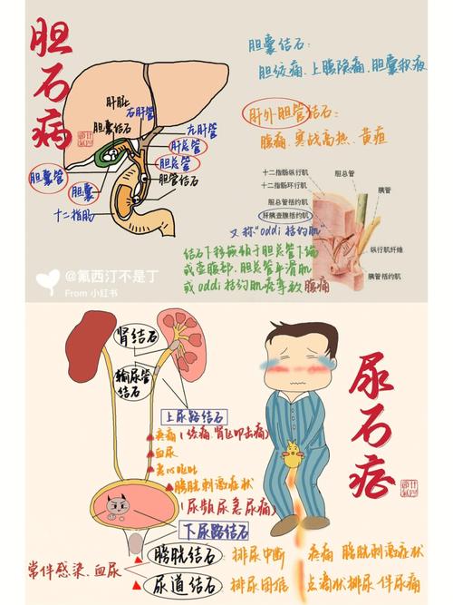 胰源性腹泻怎样治疗好