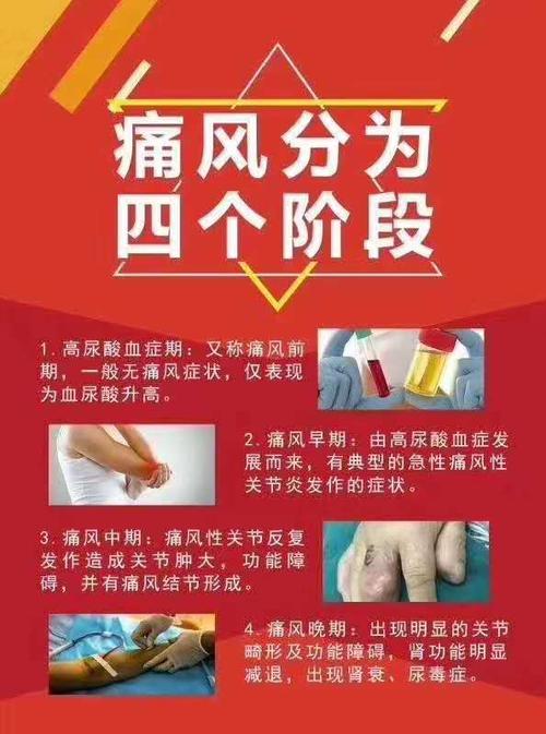 痛风应该注重什么