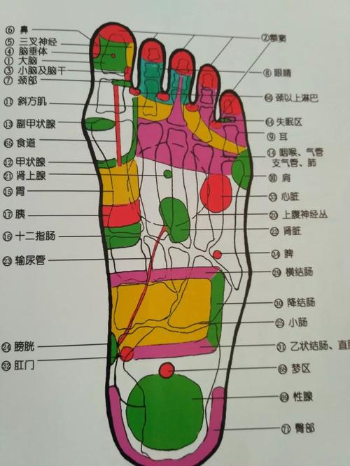 脚底板疼痛是痛风吗