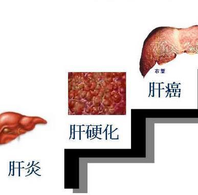 肝癌会传染给下一代吗